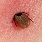 Tulane University Researchers Uncover Promising Treatment Strategy for Persistent Neurological Symptoms of Lyme Disease