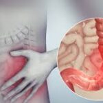 Dietary Adjustments Prove Effective in Alleviating Irritable Bowel Syndrome Symptoms