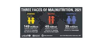 Three face of Malnutrition -stunting, wasting,overweight 2021 JME