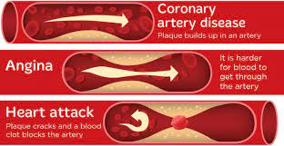 Why the heart matters: a cardiologist’s perspective