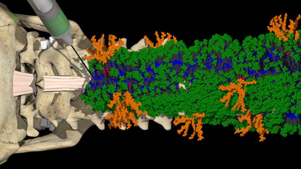 ‘Dancing molecules’ successfully repair severe spinal cord injuries