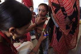 WHO issues new guideline to tackle acute malnutrition in children under five