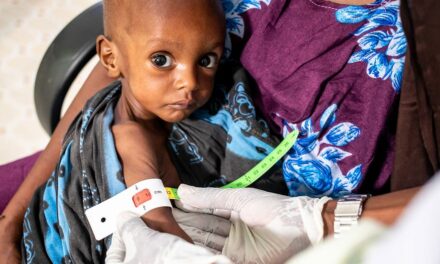 ‘Unprecedented’ malnutrition crisis in Africa: 75 per cent unable to afford healthy food