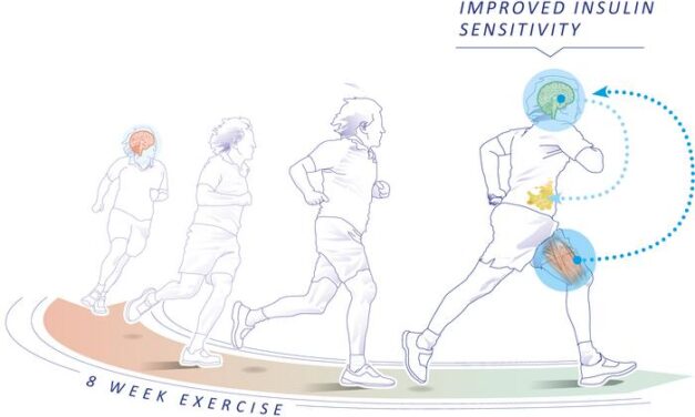 Exercise restores brain insulin sensitivity in sedentary adults who are overweight and obese