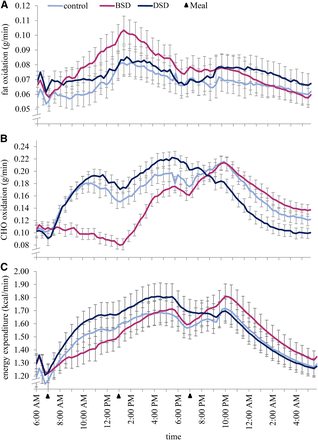 Impact of breakfast skipping compared with dinner skipping on regulation of energy balance and metabolic risk