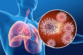 Middle East Respiratory Syndrome – Oman