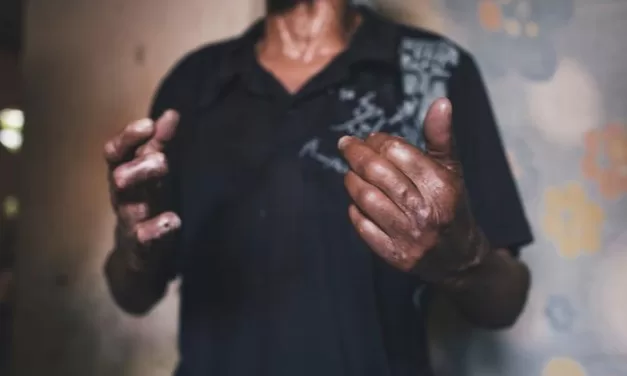 Delhi to Mandate Leprosy Reporting: A Strategic Shift to Eradicate the ‘Hidden’ Burden