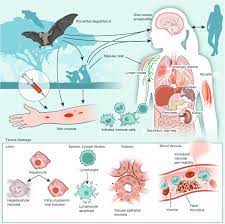 Marburg virus disease – Equatorial Guinea