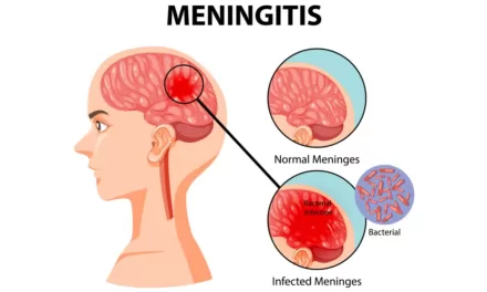 Pneumococcal meningitis – Togo