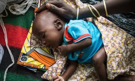 Horn of Africa: Over 7 million children under the age of 5 remain malnourished