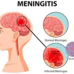 UK Experts Back Routine MenB Vaccine For 15-Year-Olds Following Unprecedented Teen Outbreak