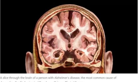 Dementia risk linked to blood-protein imbalance in middle age