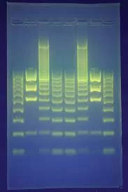 Breakthrough Discovery: Swedish Researchers Identify Gene that May Halt Muscular Dystrophy Progression