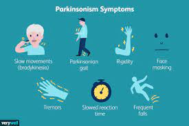 Young-Onset Parkinson’s Disease: A Growing Concern Among Health Experts