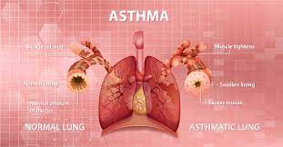 Research Uncovers Potential Harm of Burning Candles and Fumes for Individuals with Mild Asthma