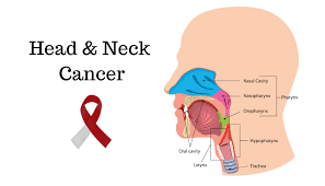 Breakthrough Urine Test Offers Hope for Early Detection of Head and Neck Cancer