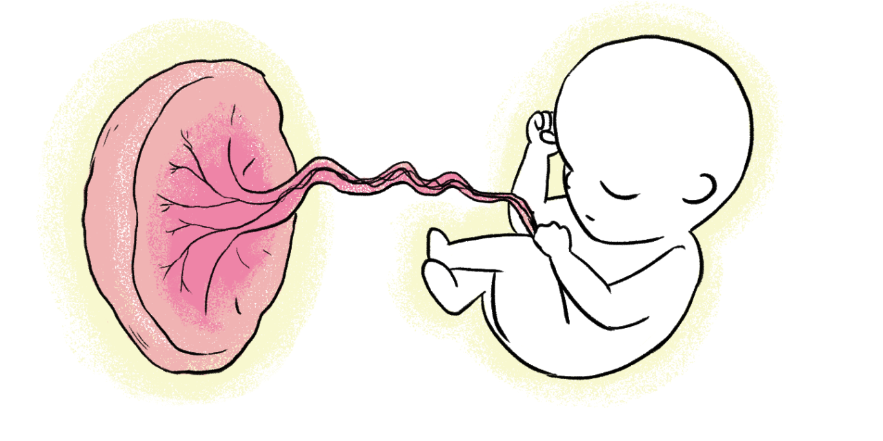 Study Reveals Placenta’s Crucial Role in Unexplained Pregnancy Losses