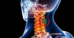 Scientists provide further understanding of the mechanisms behind cancer’s potential spread to the spine