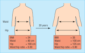 “Waist-Hip Ratio Emerges as a More Potent Predictor of Mortality Than BMI”