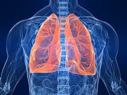 Research indicates that individuals with lung conditions encounter heightened risks due to the effects of climate change