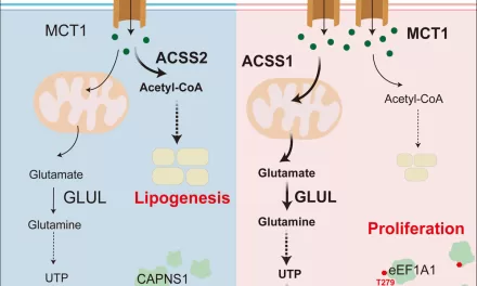 High Fructose Diet Linked to Aggressive Liver Cancer Growth