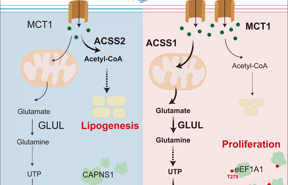 High Fructose Diet Linked to Aggressive Liver Cancer Growth