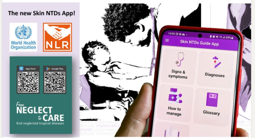 Skin-related neglected tropical diseases: WHO launches new version of the WHO Skin NTDs mobile application