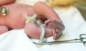 The Lancet study suggests that delaying the clamping of the umbilical cord in premature babies could potentially reduce the risk of death by half