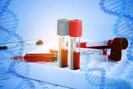 Gene Therapy Offers Promising Cure for Haemophilia, Say Experts on World Haemophilia Day