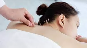 Acupuncture Shows Promise in Improving Symptoms of Meniere’s Disease