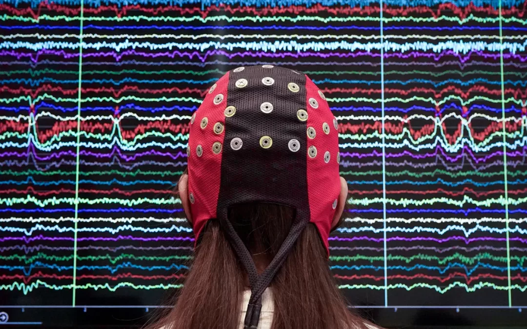 Breakthrough EEG Tool Reduces Epilepsy Misdiagnoses by 70%