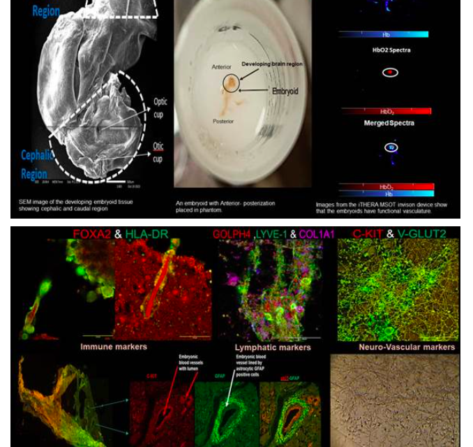 Breakthrough in Neurovascular Organoid Research Offers New Insights into Brain Functioning