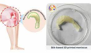 IIT Guwahati Researchers Develop Innovative Solutions for Treating Hard-to-Treat Knee Meniscus Tears