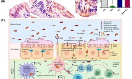 University of Missouri Researchers Find Red Cabbage Juice Offers Promise in Alleviating Inflammatory Bowel Disease