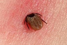 Tulane University Researchers Uncover Promising Treatment Strategy for Persistent Neurological Symptoms of Lyme Disease