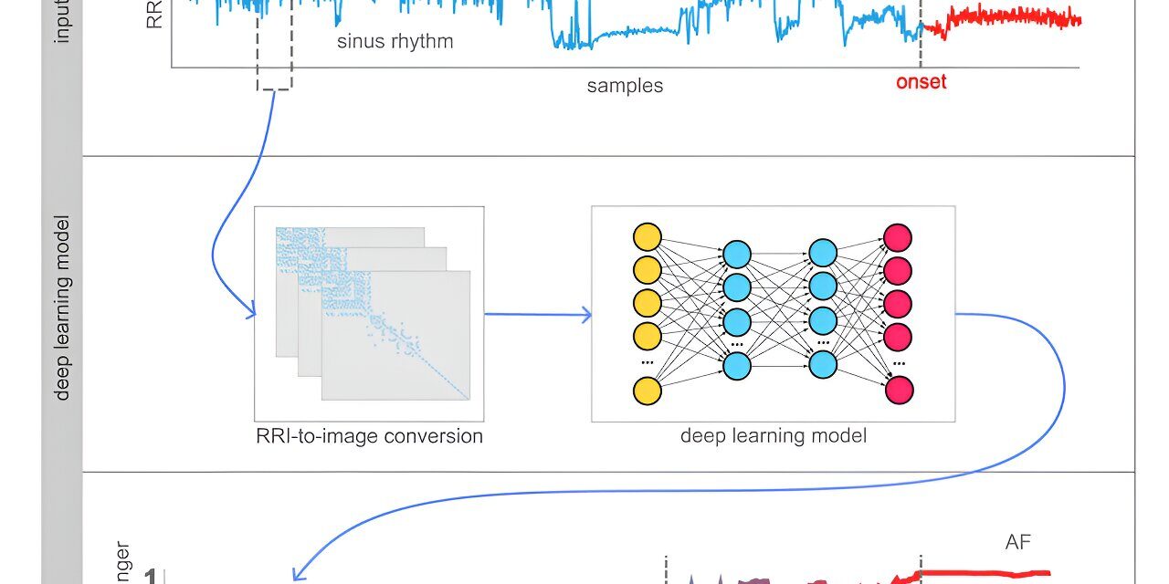 Breakthrough in Cardiac Health: Deep-Learning Model Predicts Onset of Atrial Fibrillation