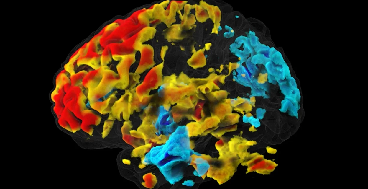 Controversy Surrounds Reproducibility of Breakthrough Brain Imaging Technique