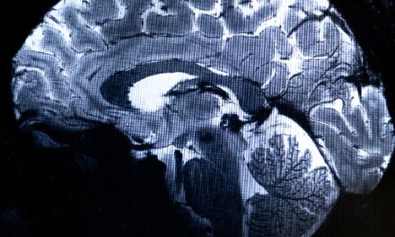 Breakthrough Study Reveals Brain Mechanisms Underlying Psychosis