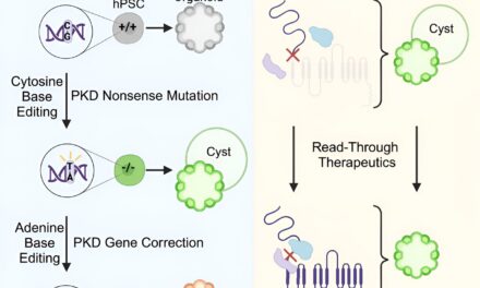 Breakthrough Study Reveals Promising Strategies for Treating Polycystic Kidney Disease (PKD)