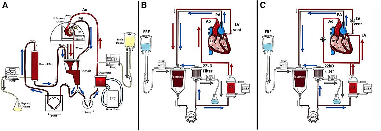 Breakthrough Study Extends Heart Preservation to 24 Hours, Revolutionizing Transplantation Potential