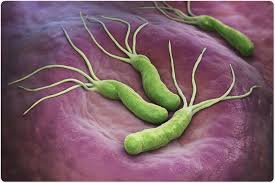 Antibiotics for H. pylori Infection May Reduce Colorectal Cancer Risk, Study Shows