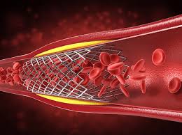 NIH Scientists Unmask the Hidden Secrets of “Bad” Cholesterol