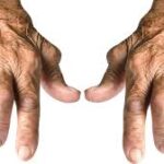 Bidirectional Association Found Between Rheumatoid Arthritis and COPD