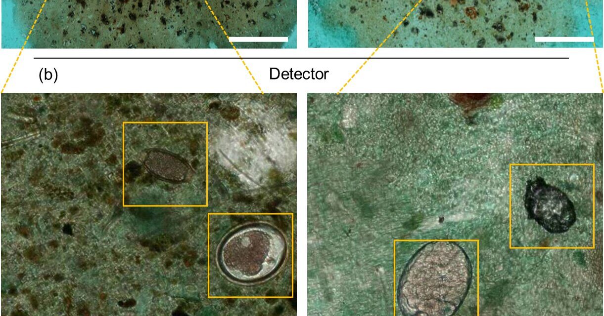 Artificial Intelligence Revolutionizes Parasitic Infection Diagnosis from Stool Samples