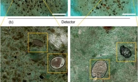 Artificial Intelligence Revolutionizes Parasitic Infection Diagnosis from Stool Samples