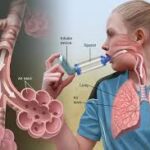 Patients With Asthma and COPD Face Increased Cancer Risk From Microplastics