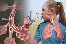 Genetics in COPD Detection: A Breakthrough Study by Mass General Brigham Researchers