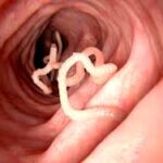 Unseen Hitchhikers: How Household Pets Are Fueling the Spread of Invasive Flatworms