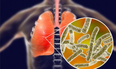 Decline in Air Pollution Linked to Rise in Legionnaires’ Disease, Study Finds