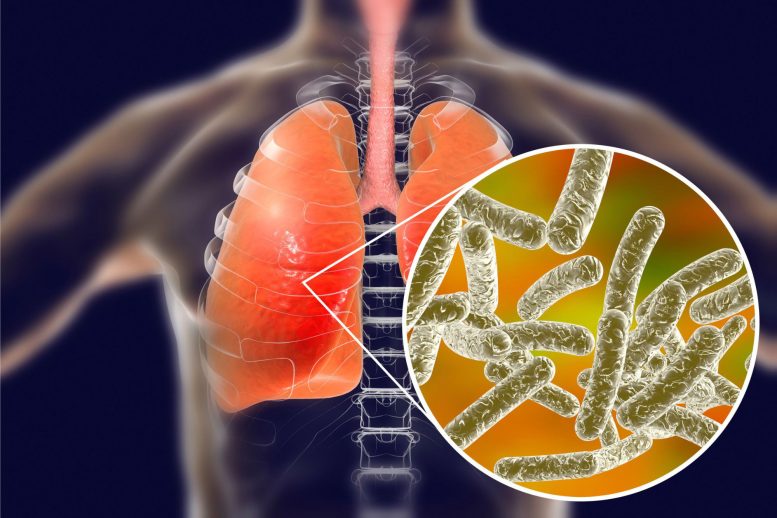 Decline in Air Pollution Linked to Rise in Legionnaires’ Disease, Study Finds